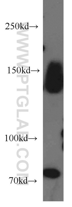 MAP4K4 Rabbit anti-Human, Mouse, Rat, Polyclonal, Proteintech 150 &mu;L;