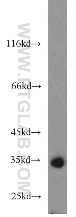 RCBTB1 Rabbit anti-Human, Mouse, Rat, Polyclonal, Proteintech:Antibodies:Primary
