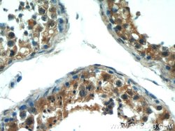 VDAC3 Rabbit anti-Human, Mouse, Rat, Polyclonal, Proteintech 20 &mu;L;