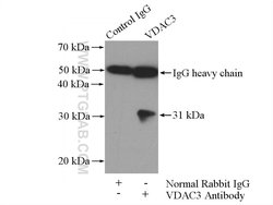 VDAC3 Rabbit anti-Human, Mouse, Rat, Polyclonal, Proteintech 20 &mu;L;