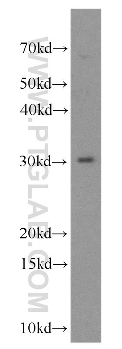 VDAC3 Rabbit anti-Human, Mouse, Rat, Polyclonal, Proteintech 20 &mu;L;