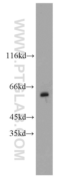 MAOB Rabbit anti-Human, Mouse, Rat, Polyclonal, Proteintech:Antibodies:Primary