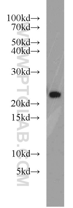 RAB8B Rabbit anti-Human, Mouse, Rat, Polyclonal, Proteintech 150 &mu;L;
