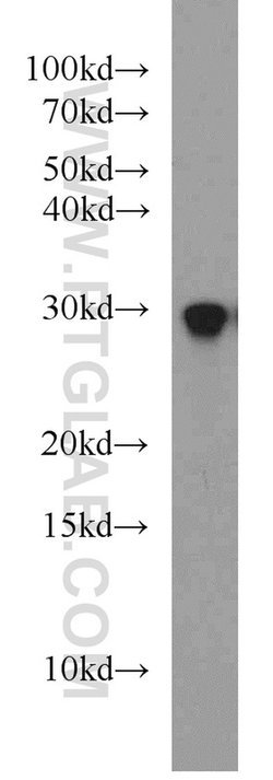 RAB8B Rabbit anti-Human, Mouse, Rat, Polyclonal, Proteintech 150 &mu;L;