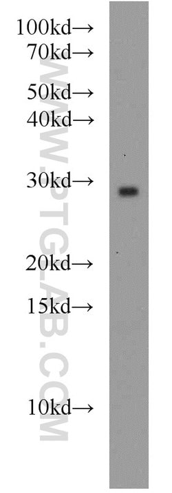 RAB8B Rabbit anti-Human, Mouse, Rat, Polyclonal, Proteintech 150 &mu;L;