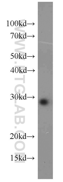 RAB8B Rabbit anti-Human, Mouse, Rat, Polyclonal, Proteintech 150 &mu;L;