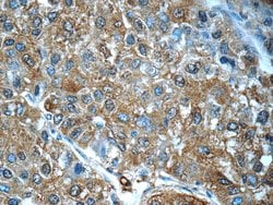 PDE2A Rabbit anti-Human, Mouse, Rat, Polyclonal, Proteintech 150 &mu;L;