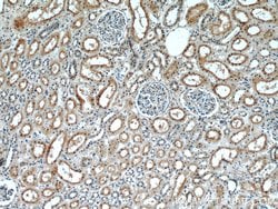 PDE2A Rabbit anti-Human, Mouse, Rat, Polyclonal, Proteintech 150 &mu;L;