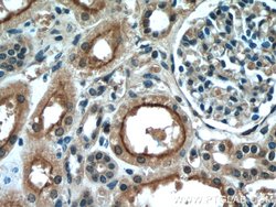 PDE2A Rabbit anti-Human, Mouse, Rat, Polyclonal, Proteintech 150 &mu;L;