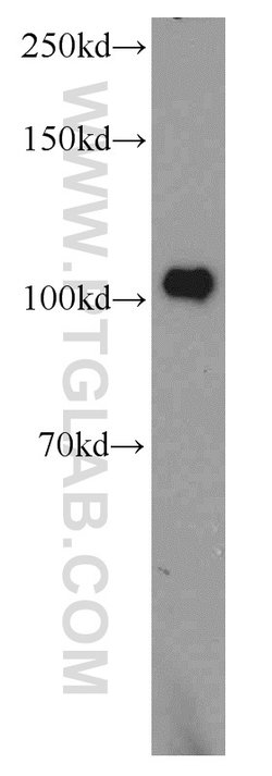 PDE2A Rabbit anti-Human, Mouse, Rat, Polyclonal, Proteintech 150 &mu;L;