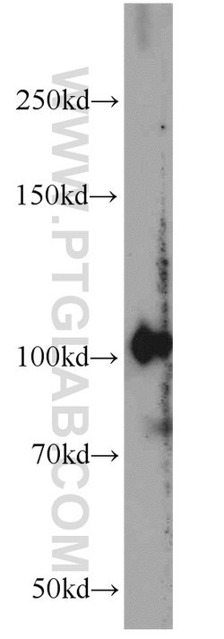 PDE2A Rabbit anti-Human, Mouse, Rat, Polyclonal, Proteintech 150 &mu;L;