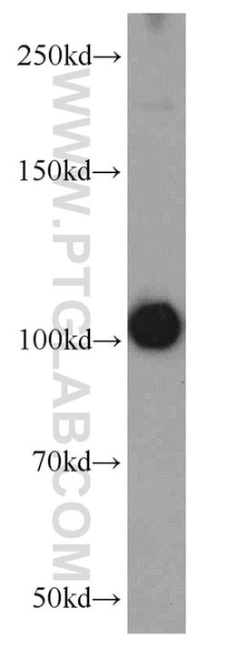 PDE2A Rabbit anti-Human, Mouse, Rat, Polyclonal, Proteintech 150 &mu;L;