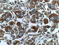 ATP6 Rabbit anti-Human, Mouse, Polyclonal, Proteintech:Antibodies:Primary