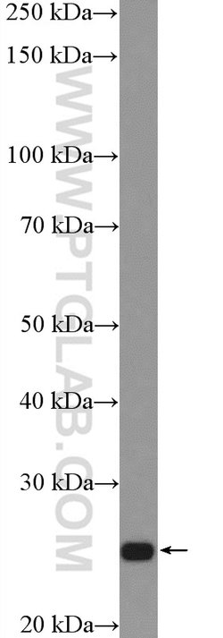 ATP6 Rabbit anti-Human, Mouse, Polyclonal, Proteintech:Antibodies:Primary