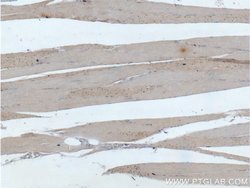 ATP6 Rabbit anti-Human, Mouse, Polyclonal, Proteintech:Antibodies:Primary