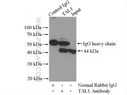 TAL1 Rabbit anti-Human, Mouse, Polyclonal, Proteintech 150 &mu;L; Unconjugated:Antibodies,