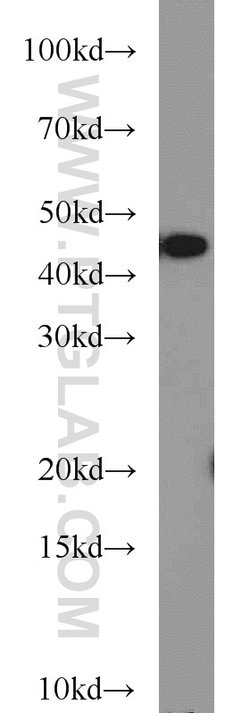 TAL1 Rabbit anti-Human, Mouse, Polyclonal, Proteintech 150 &mu;L; Unconjugated:Antibodies,