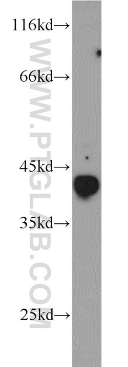 TAL1 Rabbit anti-Human, Mouse, Polyclonal, Proteintech 150 &mu;L; Unconjugated:Antibodies,