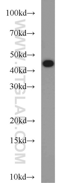 TAL1 Rabbit anti-Human, Mouse, Polyclonal, Proteintech 150 &mu;L; Unconjugated:Antibodies,