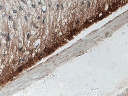 Involucrin Rabbit anti-Human, Mouse, Polyclonal, Proteintech 150 &mu;L;