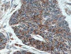 Involucrin Rabbit anti-Human, Mouse, Polyclonal, Proteintech 150 &mu;L;
