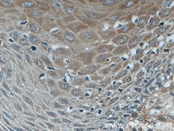 Involucrin Rabbit anti-Human, Mouse, Polyclonal, Proteintech 150 &mu;L;