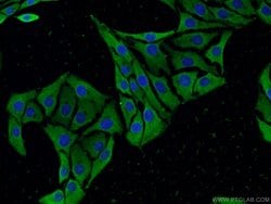 SCN10A Rabbit anti-Human, Polyclonal, Proteintech 150 &mu;L; Unconjugated:Antibodies,