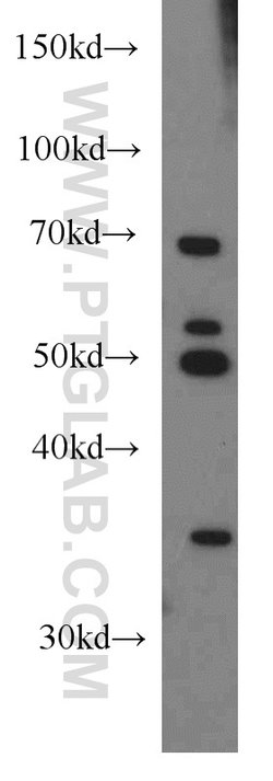 HLA-F Rabbit anti-Human, Mouse, Polyclonal, Proteintech:Antibodies:Primary