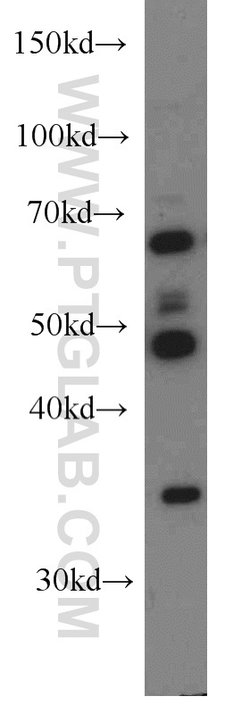 HLA-F Rabbit anti-Human, Mouse, Polyclonal, Proteintech:Antibodies:Primary