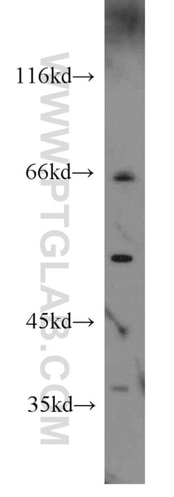 HLA-F Rabbit anti-Human, Mouse, Polyclonal, Proteintech:Antibodies:Primary