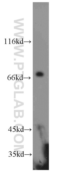 HLA-F Rabbit anti-Human, Mouse, Polyclonal, Proteintech:Antibodies:Primary