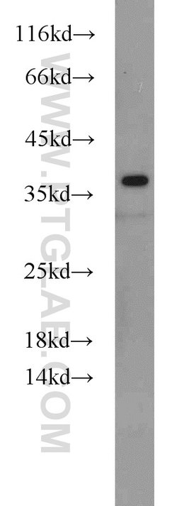 HLA-F Rabbit anti-Human, Mouse, Polyclonal, Proteintech:Antibodies:Primary