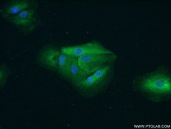 PYGB Rabbit anti-Human, Mouse, Rat, Polyclonal, Proteintech 150 &mu;L;