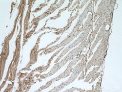 PYGB Rabbit anti-Human, Mouse, Rat, Polyclonal, Proteintech 150 &mu;L;