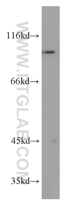 PYGB Rabbit anti-Human, Mouse, Rat, Polyclonal, Proteintech 150 &mu;L;