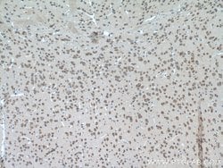 PYGB Rabbit anti-Human, Mouse, Rat, Polyclonal, Proteintech 150 &mu;L;
