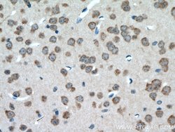 PYGB Rabbit anti-Human, Mouse, Rat, Polyclonal, Proteintech 150 &mu;L;