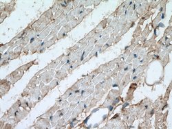 PYGB Rabbit anti-Human, Mouse, Rat, Polyclonal, Proteintech 150 &mu;L;