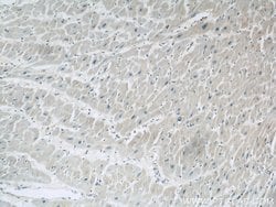 PYGB Rabbit anti-Human, Mouse, Rat, Polyclonal, Proteintech 150 &mu;L;