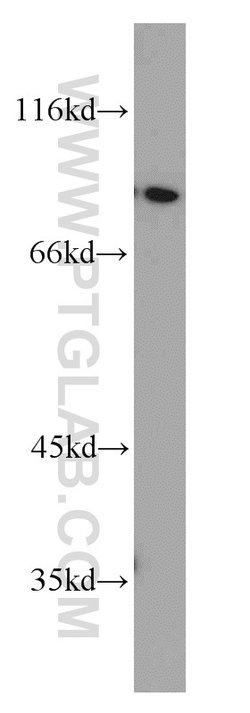 PYGB Rabbit anti-Human, Mouse, Rat, Polyclonal, Proteintech 150 &mu;L;