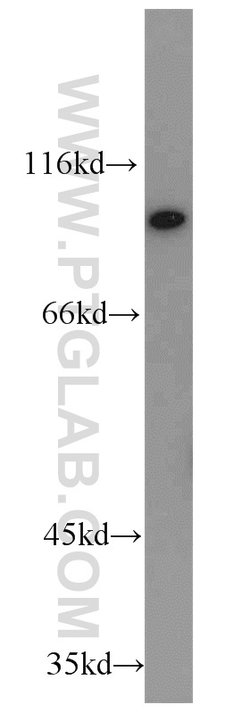 PYGB Rabbit anti-Human, Mouse, Rat, Polyclonal, Proteintech 150 &mu;L;
