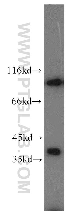 PYGB Rabbit anti-Human, Mouse, Rat, Polyclonal, Proteintech 150 &mu;L;