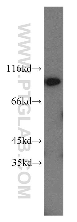 PYGB Rabbit anti-Human, Mouse, Rat, Polyclonal, Proteintech 150 &mu;L;