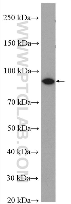 PYGB Rabbit anti-Human, Mouse, Rat, Polyclonal, Proteintech 150 &mu;L;