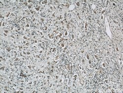 PGAP1 Rabbit anti-Human, Mouse, Polyclonal, Proteintech:Antibodies:Primary