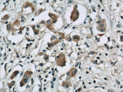 PGAP1 Rabbit anti-Human, Mouse, Polyclonal, Proteintech:Antibodies:Primary