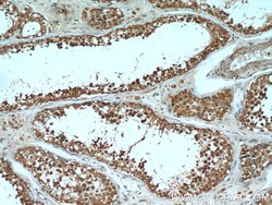 PGAP1 Rabbit anti-Human, Mouse, Polyclonal, Proteintech:Antibodies:Primary