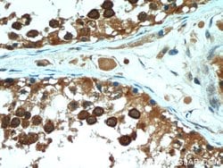 PGAP1 Rabbit anti-Human, Mouse, Polyclonal, Proteintech:Antibodies:Primary