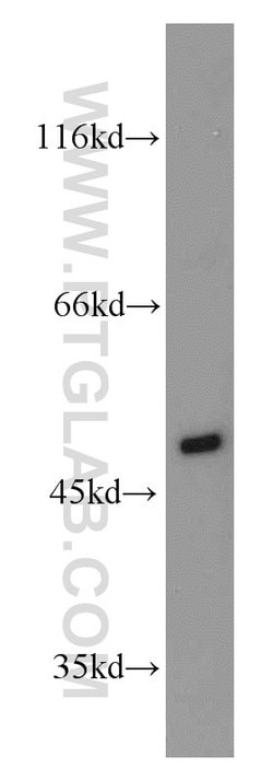 PGAP1 Rabbit anti-Human, Mouse, Polyclonal, Proteintech:Antibodies:Primary