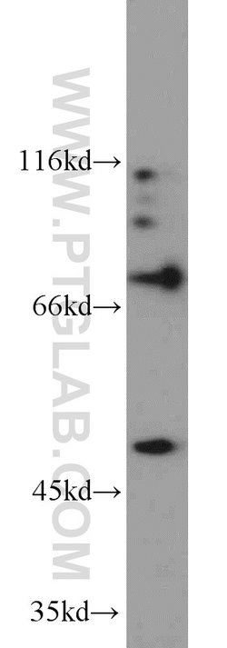PGAP1 Rabbit anti-Human, Mouse, Polyclonal, Proteintech:Antibodies:Primary